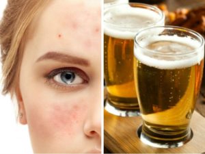 ¿Qué pasa con tu piel cuando tomas alcohol?